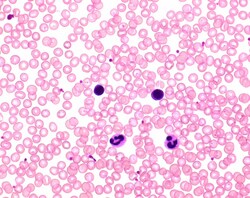 MilliporeSigma&trade;&nbsp;Hemacolor&trade; Staining Kit for Microscopy